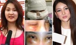 Chi gần nửa tỷ để thẩm mỹ, mỹ nhân Hoa ngữ tiền mất tật mang