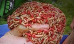 Phương pháp chữa bệnh kinh dị số 1 thế giới