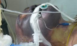 Ăn tiết canh lợn: Sướng một lần, mất một đời