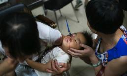 Kinh hãi cháu bé 3 tuổi bị dao cắt chỉ đâm vào giữa mắt