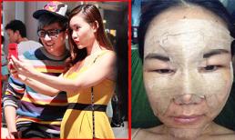 Bắt gặp Anh Thúy quấn quýt bạn trai sau phẫu thuật thẩm mỹ