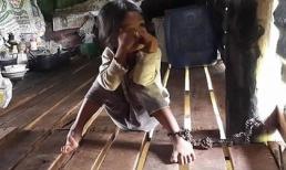 Sốc: Bé gái 4 tuổi bị xích chân vào cột nhà 8 tiếng/ngày