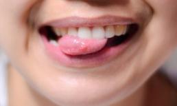 Đoán bệnh của bạn qua những biểu hiện ở lưỡi