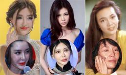 Khi người đẹp châu Á 'phá tan' khuôn mặt vì dao kéo hỏng