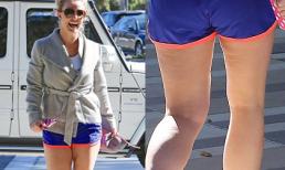 Britney Spears lộ chân nhăn nheo mỡ thừa