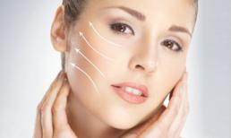 Khuyến mại lớn căng da mặt không phẫu thuật 1 lần duy nhất