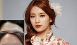 'Tình đầu quốc dân' dính nghi vấn 'dao kéo'