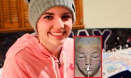 Cô gái 16 tuổi hồi phục nhanh kỳ diệu sau vụ cháy kinh hoàng