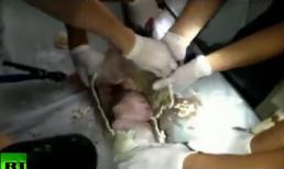 Cứu bé sơ sinh từ ống nước thải