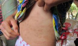 Nghi án thiếu nữ bị cha nuôi bạo hành nhiều năm ở miền Tây