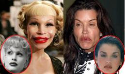 Sao 'ăn trái đắng' vì làm đẹp bằng 'dao kéo'