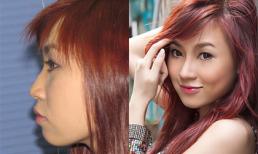 Mỹ viện Hồng Hạnh - Thẩm mỹ được giới nghệ sĩ tín nhiệm