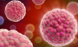 Phát hiện thêm yếu tố làm tăng nguy cơ ung thư buồng trứng