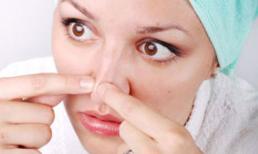 3 bước để mụn biến mất nhanh nhất