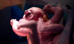 7 lý do “ngớ ngẩn” khi chọn đẻ mổ