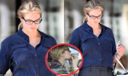 Kate Upton lộ trán đầy vết đỏ, thản nhiên ngồi nhổ ria mép