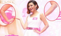 Selina tự tin 'khoe' tay đầy sẹo