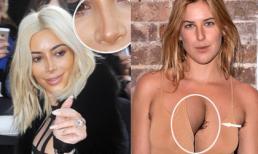 Những khoảnh khắc đáng xấu hổ của sao Hollywood