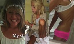 Cô gái “da bọc xương” vì ham giảm cân