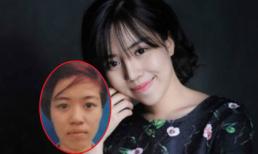 9X phẫu thuật thẩm mỹ toàn mặt vì sợ chồng 'chán'