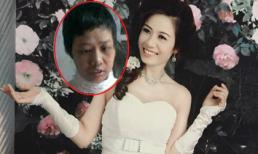 Chuyện cảm động về người mẹ hy sinh đôi mắt để sinh con