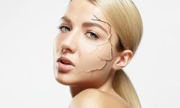 Sai lầm khi chăm sóc khiến da mất nước nghiêm trọng