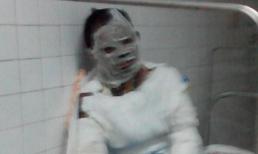 Xót xa người vợ tự thiêu vì bị chồng bạo hành hơn 5 năm