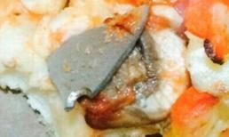 Kinh hãi bé gái ăn phải lưỡi dao dài hơn 2cm trong bánh