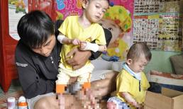 Hai bé rụng ngón chân, ngón tay vì mắc bệnh quái ác