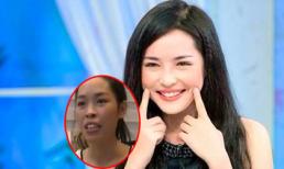 Loạt 9X đổi đời sau phẫu thuật thẩm mỹ