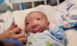 Cậu bé đáng thương sinh ra không có mũi