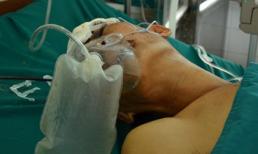 20 người tiếp máu cho 3 cha con bị giang hồ chém trong đêm