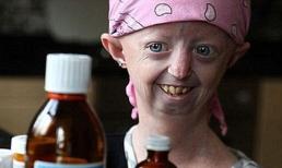 Cô gái 17 mắc kẹt trong cơ thể của bà lão trăm tuổi đã qua đời