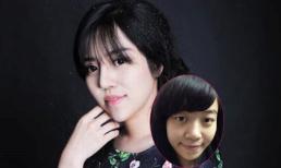 Sự thay đổi của 9X phẫu thuật thẩm mỹ để giữ chồng