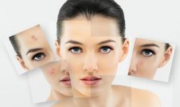 Điểm danh những thực phẩm hại da bạn nên tránh