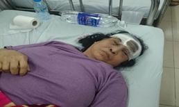 Giận chồng, 'nàng dâu' gọi người đến hành hung mẹ chồng dã man