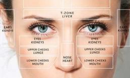 Vị trí mọc mụn nói gì về sức khỏe của bạn?