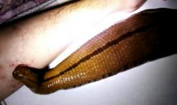  Chàng trai nuôi đỉa làm thú cưng, cho ăn bằng máu mình