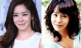 Sao 'Chuyện tình Paris' Kim Jung Eun lộ mặt méo mó