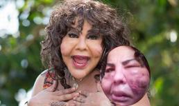 Người phụ nữ chuyển giới mặt 'gồ ghề' sau phẫu thuật