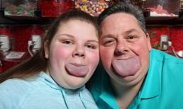 Hai cha con có lưỡi rộng nhất thế giới