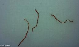  Hiện tượng mưa giun kỳ lạ trên thế giới