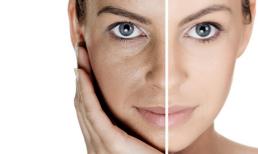 Siêu trẻ hóa toàn diện bằng bộ từ công nghệ trẻ hóa da