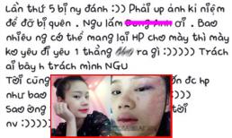 Bị người yêu đánh lần thứ 5, nữ sinh đăng ảnh để kỉ niệm