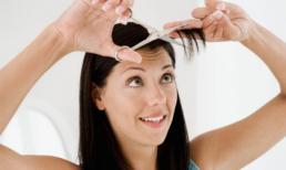 'Bí mật' giúp sạch mụn trứng cá trong 1 tuần