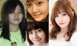 Sao Hàn thẩm mỹ 'xoành xoạch' khiến mặt thay đổi 180 độ