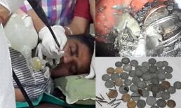 'Sởn da gà' trước chàng trai nuốt tiền xu và hàng trăm chiếc đinh