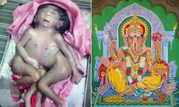 Em bé 8 chi được tôn thờ như một vị thần