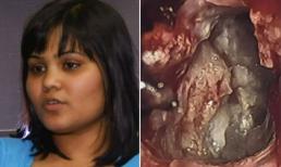 Kinh hoàng phát hiện bào thai 'song sinh' trong não