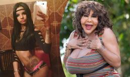 4 ca thất bại thảm hại của phẫu thuật thẩm mỹ